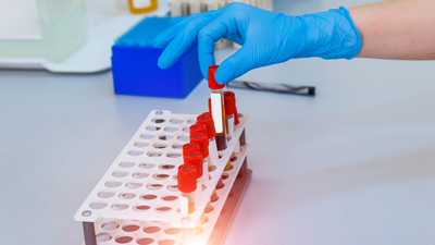 Kan grubu A olanlar dikkat!