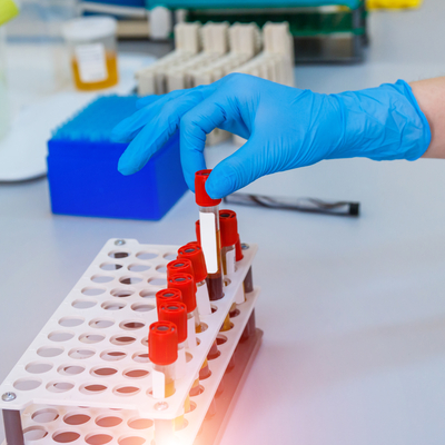 Kan grubu A olanlar dikkat!