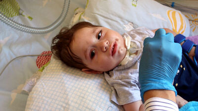 SMA'lı Aybars bebek 3 kez kalp krizi geçirdi