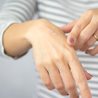 Yara izi nedir, neden olur ve nasıl geçer?