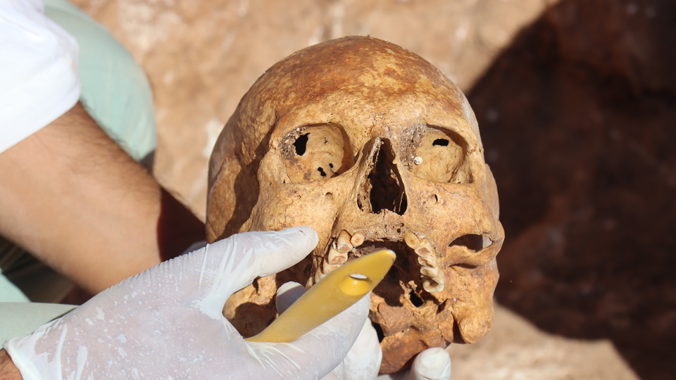 Kommagene Krallığı'na dayanan 1800 yıllık iskeletler Adıyaman'dan çıktı!