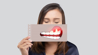 Diş eti şişmesi neden olur, nasıl geçer?