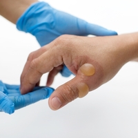 Su toplaması neden olur, nasıl geçer?