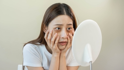 Göz altı morluklarına iyi gelen şeyler