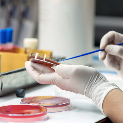 Her 2.8 saniyede bir kişiyi öldürüyor!