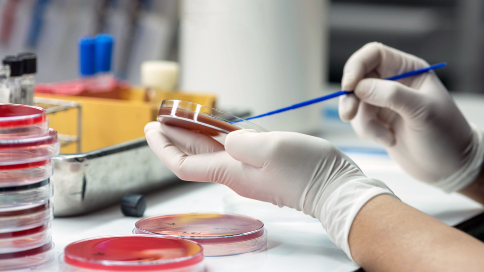 Her 2.8 saniyede bir kişiyi öldürüyor!