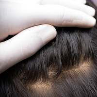 Bit neden olur, ne iyi gelir?