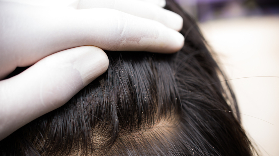 Bit neden olur, ne iyi gelir?