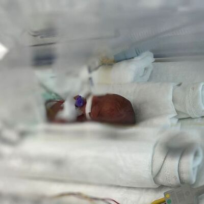 Mucize! 320 gram doğmuştu...