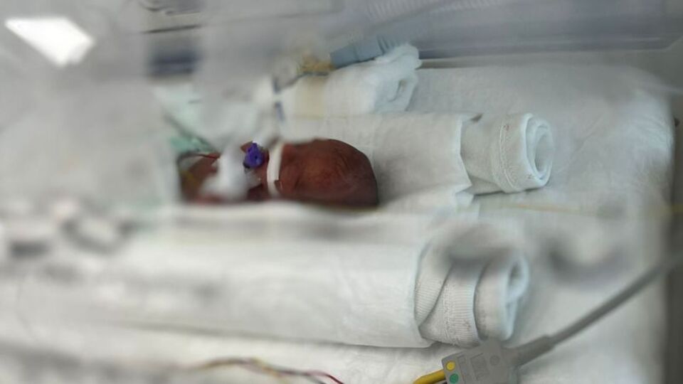 Mucize! 320 gram doğmuştu...