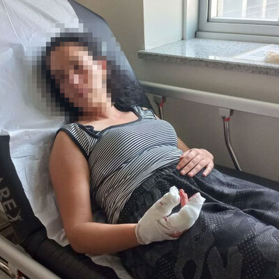 Konuşmak için çağırdı! Burnunu ve dişlerini kırdı!