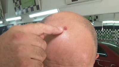 Kiminin kafası kiminin yüzü şişti! Tehlike şimdi de İzmir'de