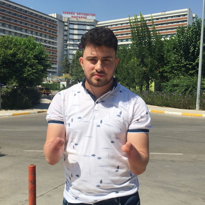 Elleri olmadan dünyaya gelmişti! İşte çift kol nakli bekleyen Alihan'ın hayali