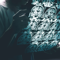 Ekonominin Alzheimer üzerinde de etkisi var