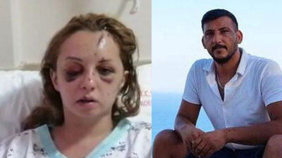 Sosyal medyada gündem olmuştu! Yoğun bakımdan çıktı! Dehşeti anlattı!