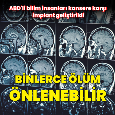 Beyin kanserine karşı implant geliştirildi! Binlerce ölüm önlenebilir