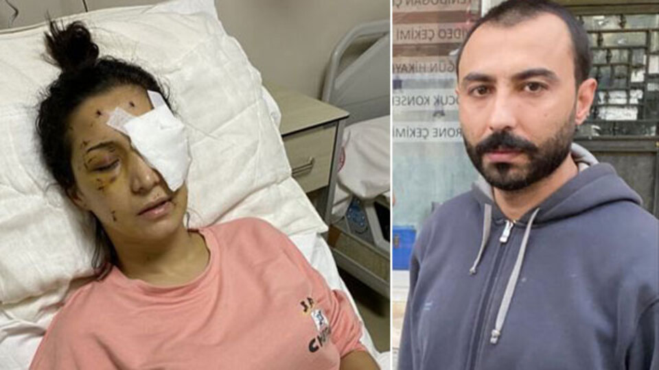 Yengesini 37 kez bıçaklamıştı! İşte verilen ceza!