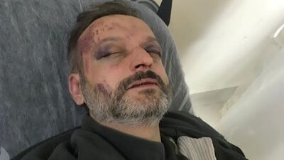 İstek parça gecikti diye! Öldüresiye dövdüler!