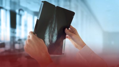 Meme kanseri sıklığı son 20 yılda iki kattan fazla arttı!