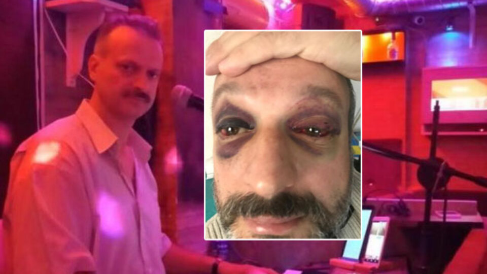 İstek parça için 9 kişi dövdü! Bu dayağa ceza yok!