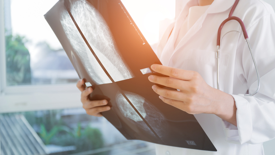 Hayata "evet" demek için kansere "hayır" dedi