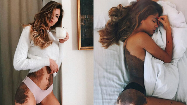 'Dalmaçyalı' diye alay etmişlerdi! Böyle karşılık verdi!