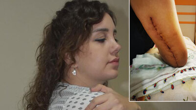 Sevgilisi kolunu kırdı! İyi halden serbest!