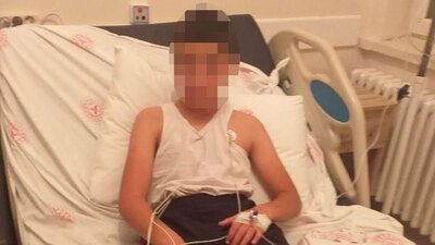 Kuduz tanısı konan çocuğun babası konuştu! "Önce kolunda kaşınma oldu! Durumu kritik"