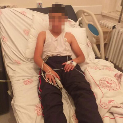 Kuduz tanısı konan çocuğun babası konuştu! "Önce kolunda kaşınma oldu! Durumu kritik"