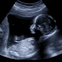 Dünyada bir ilk! Ölümcül hastalık bebek doğmadan tedavi edildi