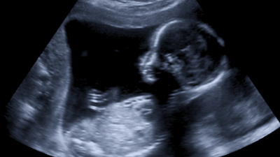 Dünyada bir ilk! Ölümcül hastalık bebek doğmadan tedavi edildi