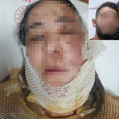 Üvey anneye kezzaplı saldırı!