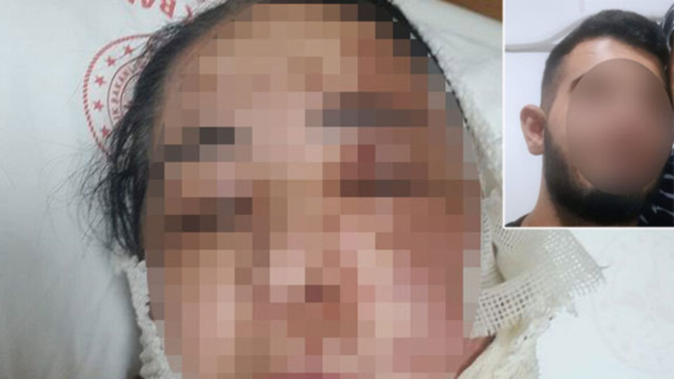 Üvey anneye kezzaplı saldırı!