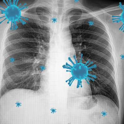 Zatürreye karşı 8 etkili öneri!