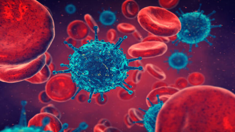 Zatürre, enfeksiyona bağlı ölüm nedenleri arasında ilk sırada