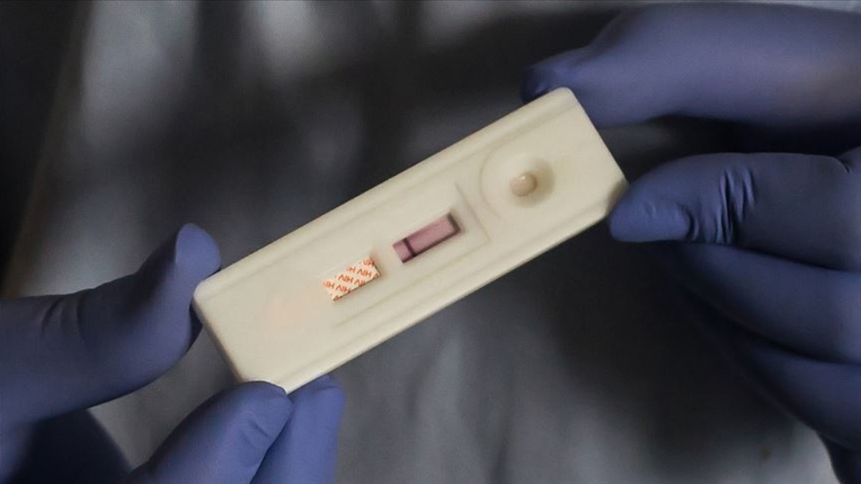 Türkiye'de 32,376 kişi HIV ile yaşıyor