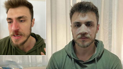 "Eşime kadın doktor baksın" dedi! Doktorun burnunu kırdı!