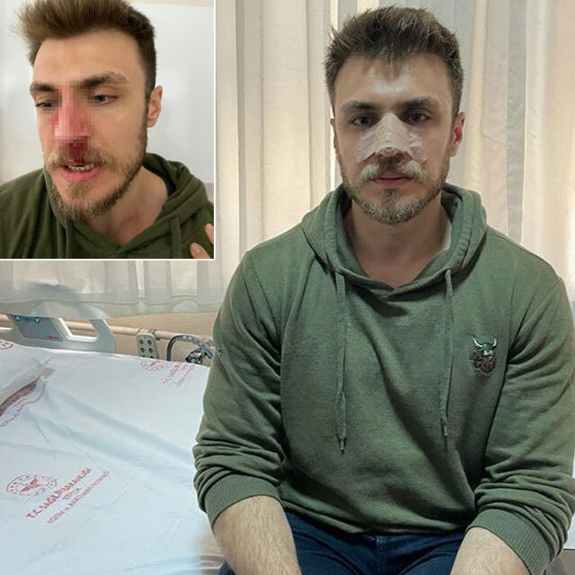 "Eşime kadın doktor baksın" dedi! Doktorun burnunu kırdı!
