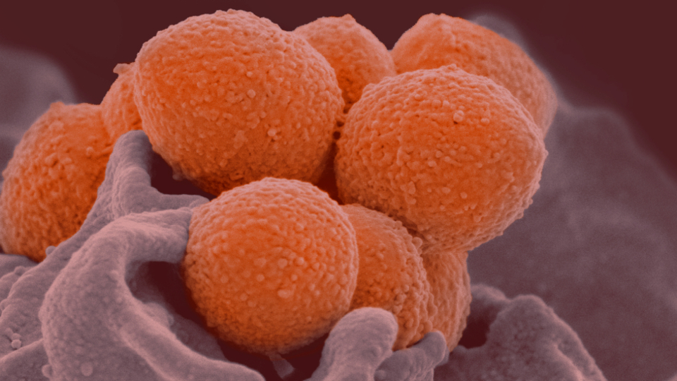 İngiltere'de Strep A alarmı! 6 çocuk öldü