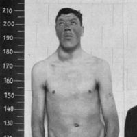 Cüce olarak doğdu ama öldüğünde 2 metreden fazlaydı: Hem cüce hem dev olan genç adam