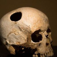 Eskiden insanlar kendilerini nasıl tedavi ediyordu?