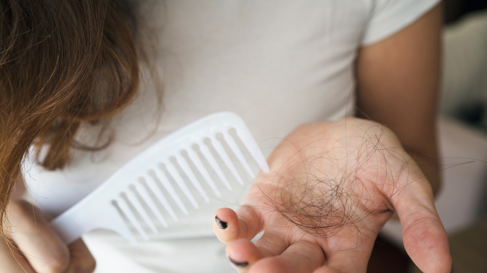 Rüyada Saç Dökülmesi