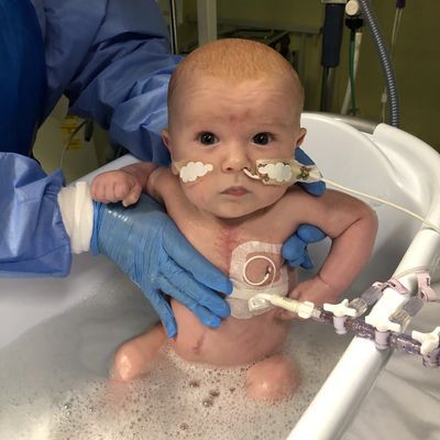 Dünyada ilk! Bebeğin kalbine kök hücre dokunuşu