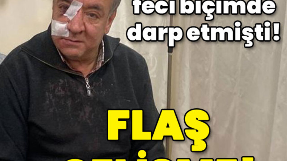 30 yıllık doktoru feci biçimde darp etti! Flaş gelişme!