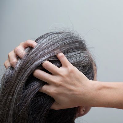 Saçı en çok ne beyazlatıyor? Stres mi kötü beslenme mi?