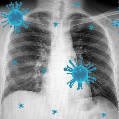 Domuz gribi mi soğuk algınlığı mı?