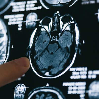 Travma yaratan anılarla ilgili dikkat çeken araştırma