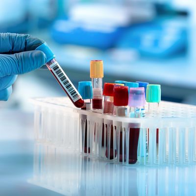 Alzheimer’ı teşhis eden kan testi geliştirildi