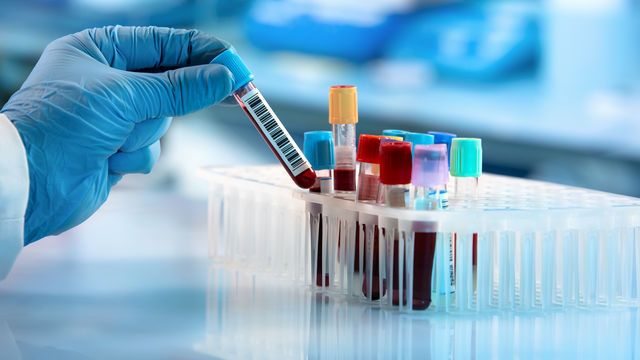 Alzheimer'ı teşhis eden kan testi geliştirildi
