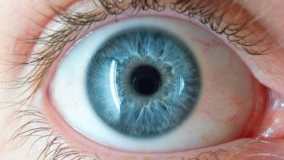 Aklınıza gelir miydi? Bunu yapan sinüzit